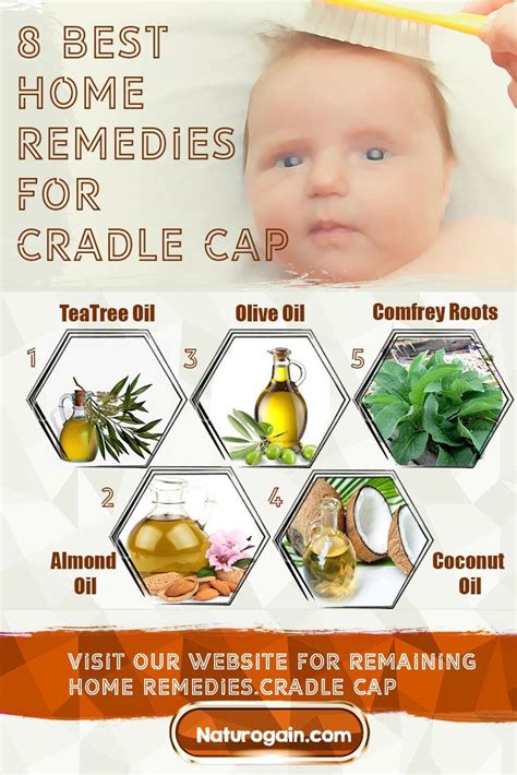 cradle cap in the elderly|adult cradle cap home remedies.